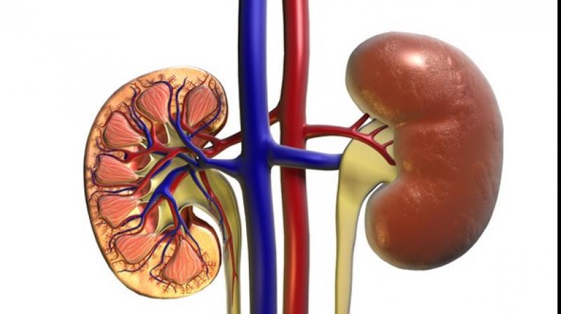 Kidney transplants often fail; hereâ€™s why