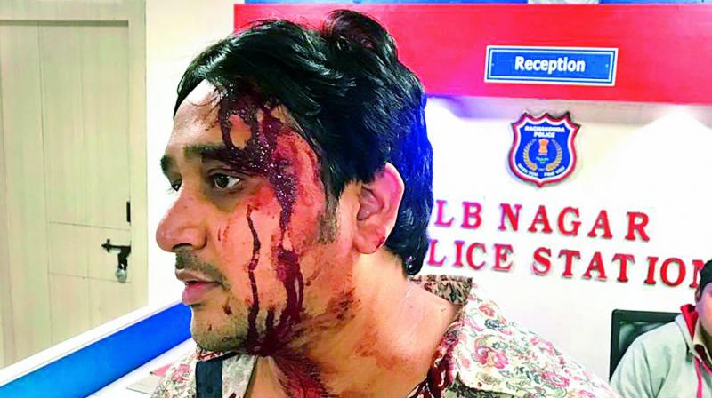 The whole episode was recorded in the CCTV. Raza, who suffered severe injuries on his head, alerted the police. (Photo: DC)