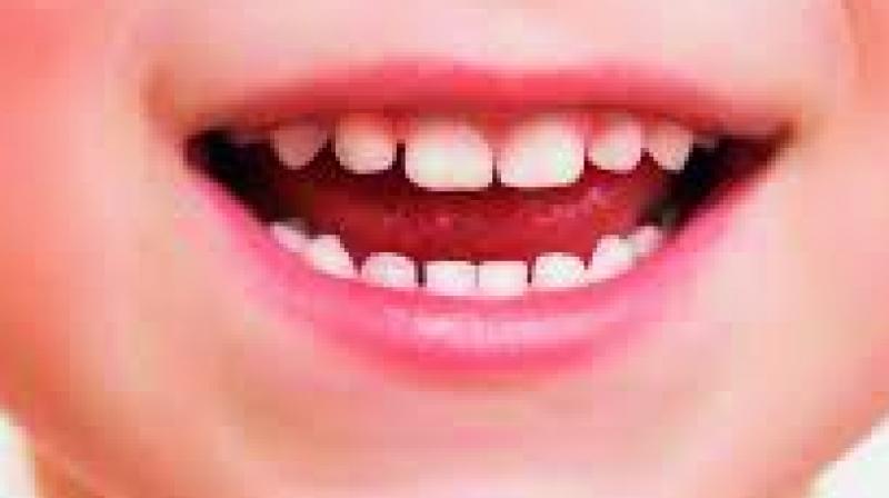 World Oral Health day: Quality smile gets you ahead