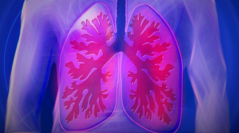 Lung cancer cases in COPD patients can be reduced by steroids