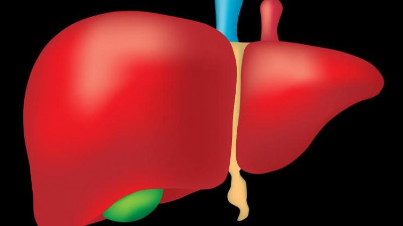 The cost of the cure for liver disease is very high and it is estimated that 25 crore people are suffering from it.   (Representational Image)