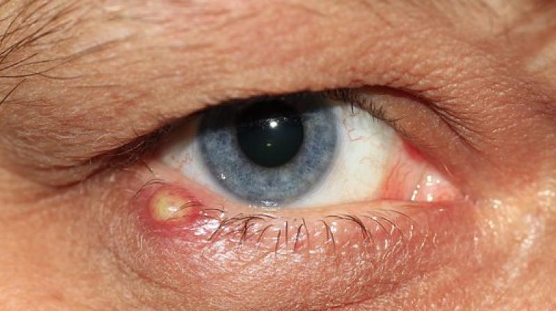 Gene therapy can free patients from eye infections