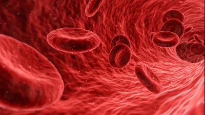 Physicians employed a technique that avoids the use of high-dose chemotherapy and radiation in preparation for a stem cell transplant. (Photo: Pixabay)