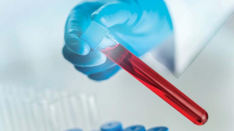 Liquid biopsy a game changer in cancer testing