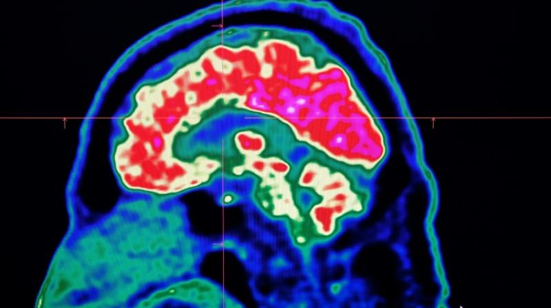 Our brains control how we perceive pain
