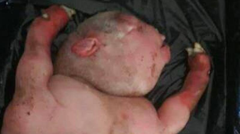 Beast which looks like a half-human-half animal was given birth by a sheep (Photo: Facebook)