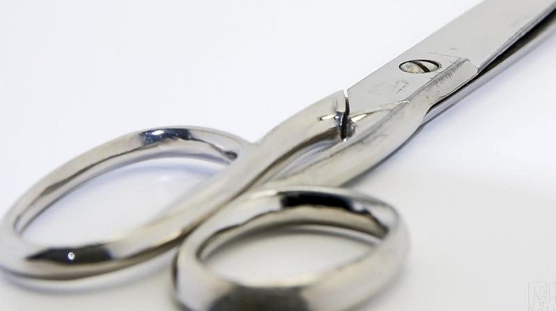 On December 15th, medical practitioners accidentally cut off the head of the boys penis with a pair of scissors. (Photo: Pixabay)