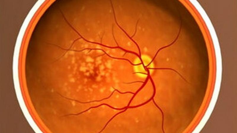 Lower eye diseases with healthy diet