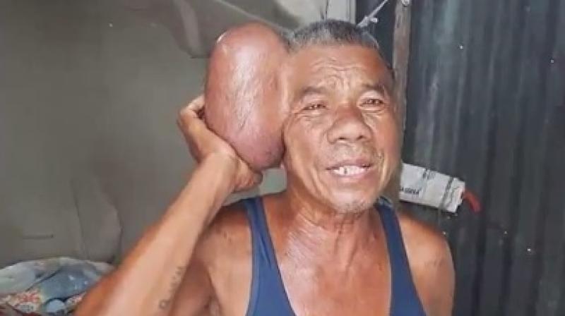 He once said he wanted to die and end the suffering (Photo: YouTube)