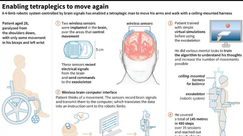 Brain-controlled exoskeleton helps paralysed man walk again