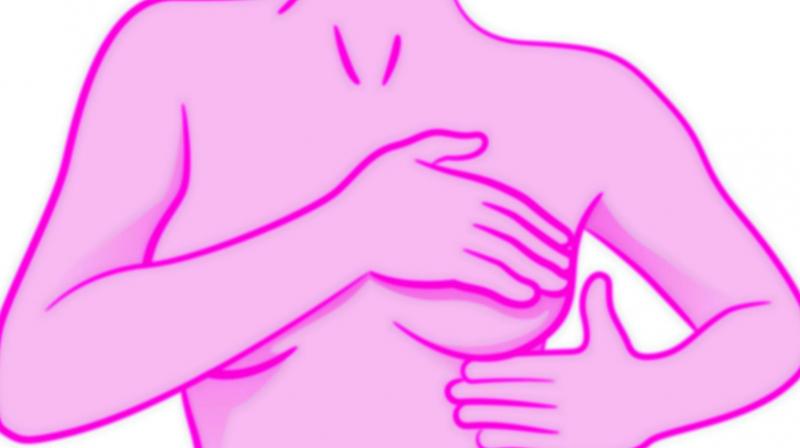 Breast cancer is the very common and accounts for 27 per cent of cancer cases in Indian women