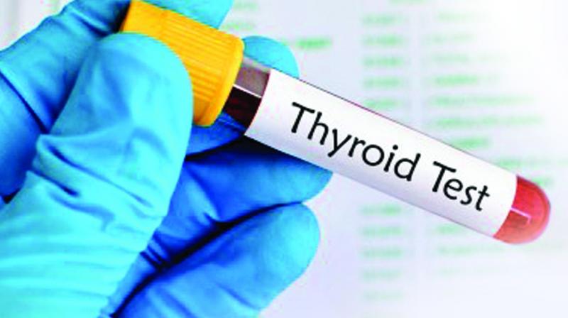 Most cases of hypothyroidism were seen in North India with Delhi registering 25 per cent of the cases. East India showed sub-clinical hypothyroidism with 20 per cent in Kolkata.