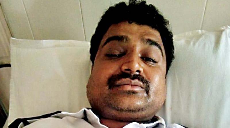 BMTC driver assaulted, injured by gang of eight