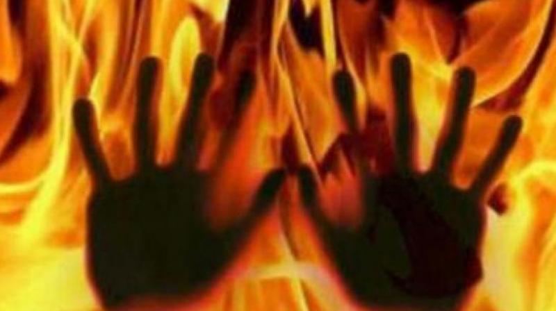 Dalit man, mistaken for thief and set afire, dies in UP
