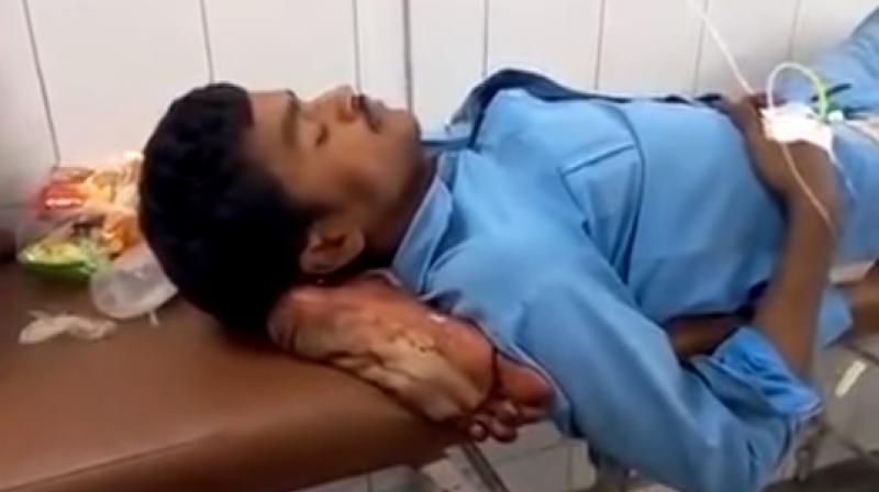 A video footage of the same has emerged however, it is unclear if he was aware of what he was lying on while his severed leg was propped up. (Youtube Screengrab/ My India)