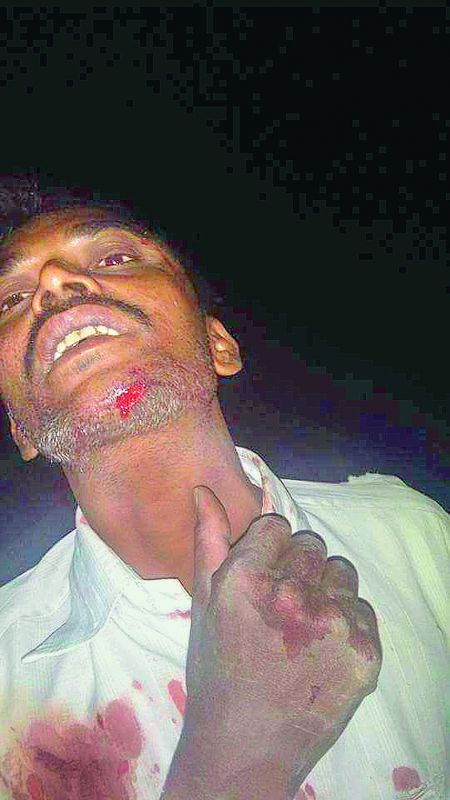Man attacked by a leopard at Tandur in Vikarabad.