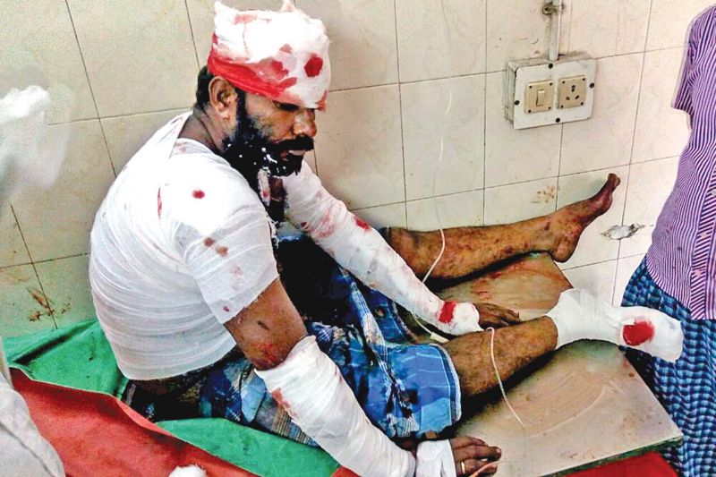One of the injured receiving  treatment at KMC hospital (Photo: DC)