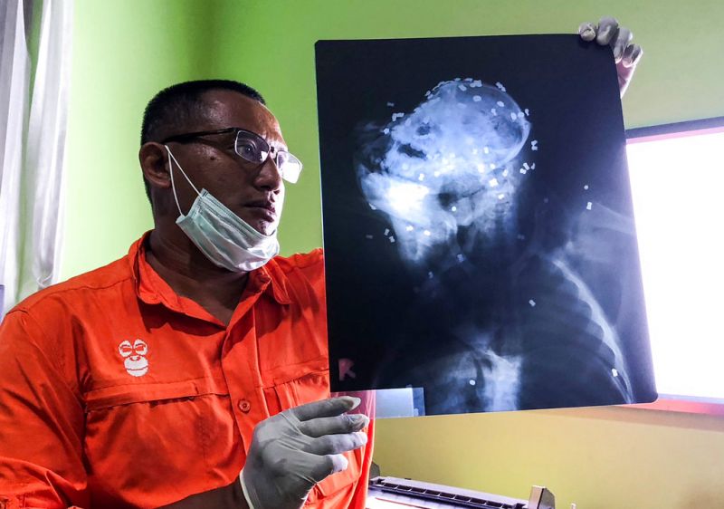 Photo released by Center for Orangutan Protection (COP), Principal of COP Hardi Baktiantoro holds an x-ray showing air rifle pellets lodged in the head and body of an orangutan during its surgery in East Kalimantan, Indonesia. 
