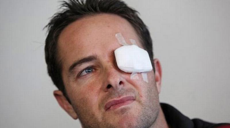 South African wicketkeeper Mark Boucher was struck by the bails in the left eye during the opening match of South Africas 2012 tour of England. He had undergone a long surgery but eventually had to retire. (Photo: AP)