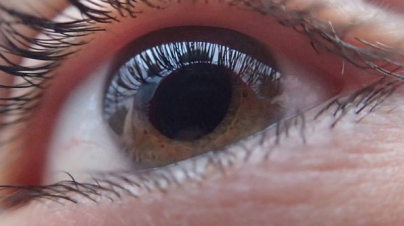 Cataracts may increase depression symptoms: study