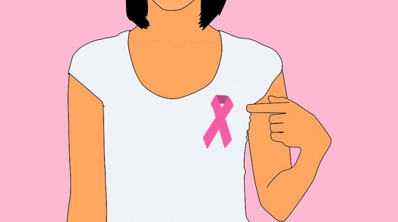 Researchers surveyed 1,006 women who were treated for early stage breast cancer and were employed at the time of their diagnosis. (Photo: Pixabay)