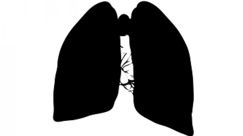 A report released by the Centre for Science and Environment (CSE) yesterday says every third child in Delhi has impaired lungs. (Photo: Pixabay)