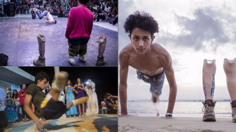Amputee breakdancers daily life captured in inspiring photo series