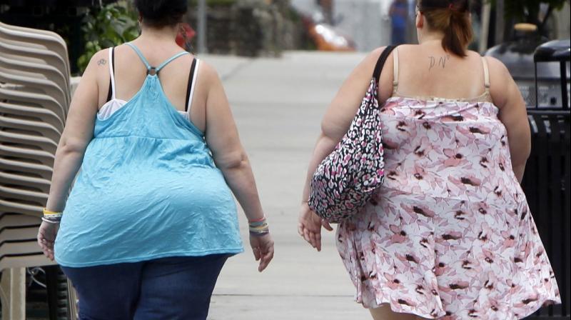 Aside from health risks, obesity may present technical and logistical challenges during physical examinations and certain medical procedures. (Photo: AP)