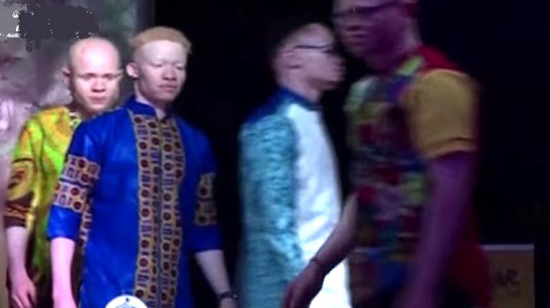 People with albinism are seen as not beautiful, as not good-looking, and that has an effect on their self esteem (Photo: AFP)