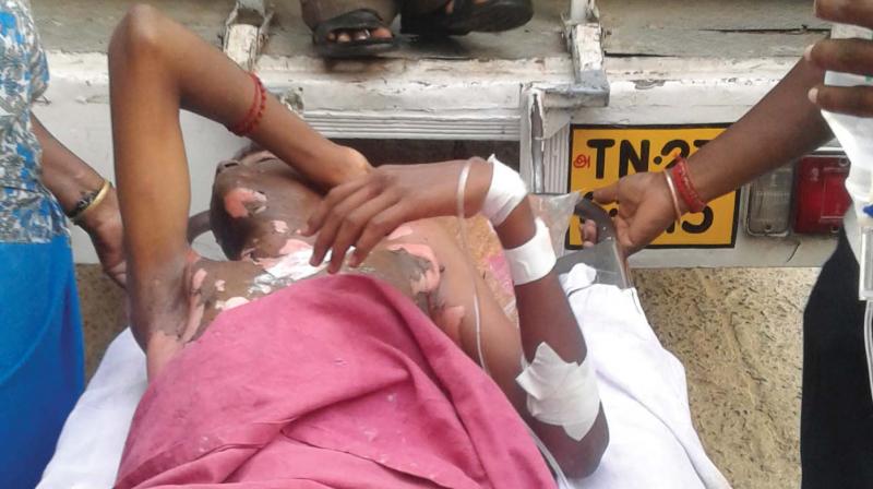 R. Logesh, 17, of Satya Nagar in Salem, suffered a severe shock, when he climbed atop a train and came in contact with an overhead high voltage electric line.