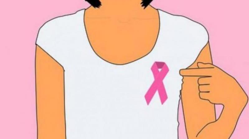 New protein discovered linked to breast cancer growth