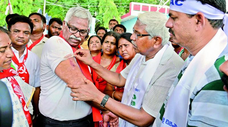 TJAC chief Prof. Kodandaram shows a protester injured in the lathi-charge during the Chalo Indira Park protest march in Hyderabad on Monday. (Photo: DC)