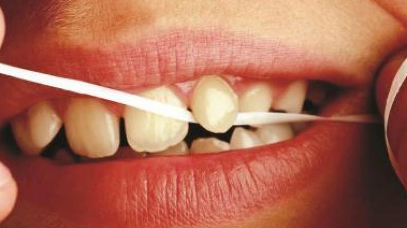 Chronic gum disease tied to risk of erectile dysfunction