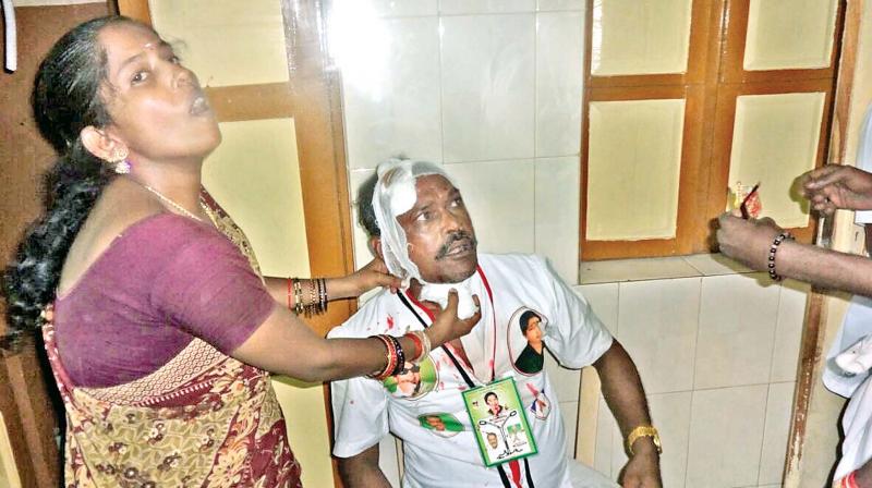 Two members of OPS team sustained head injuries after they were attacked allegedly by supporters of TTV Dhinakaran at RK Nagar on Thursday. Dhinakaran supporters Rajan Chellappa and MLA Periyapullan allegedly instigated the attack. Injured man gets treatment. (Photo: DC)