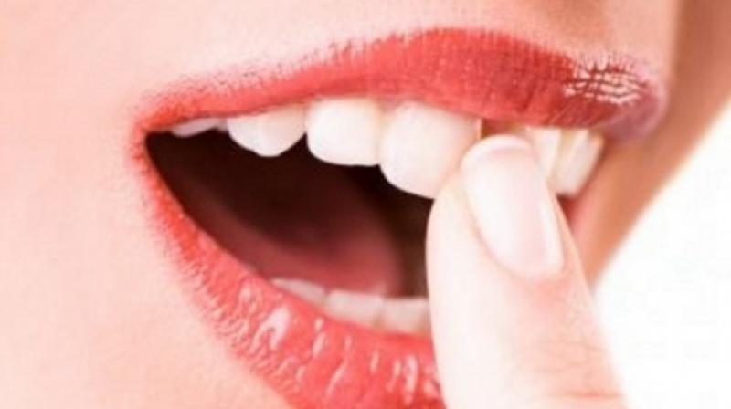 Previous research has shown that periodontal disease caused by certain oral microbiota has been associated with several types of cancer (Photo: AFP)