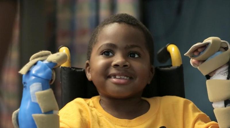In this undated handout photo provided by the Childrens Hospital of Philadelphia in Pennsylvania, Zion Harvey of Baltimore, Maryland posing with his newly transplanted hands. (Photo: AFP)