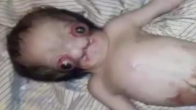 The child is said to have healthy limbs and is breathing properly (Photo: YouTube)