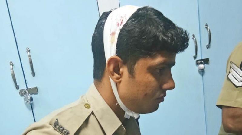 RPF constable Yogesh Kumar Meena who was kinifedby a cellphone snatcher, is under treatment. (Photo: DC)