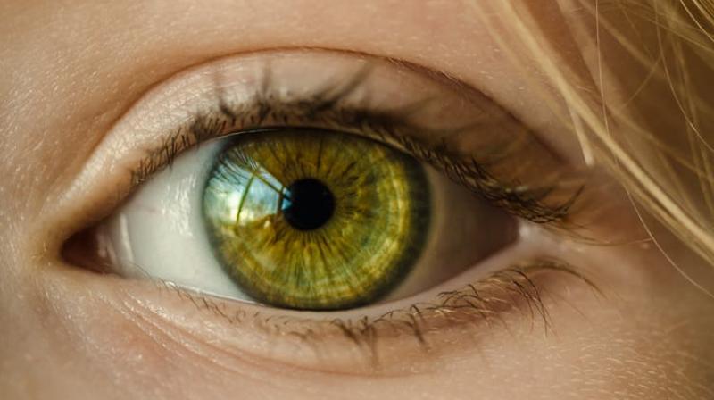 Dyslexia could be result of eye deformity. (Photo: Pexels)