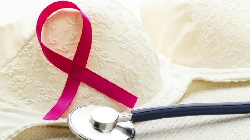 It is hugely important to catch all cancers, but particularly breast cancer , early. (Photo: AFP)