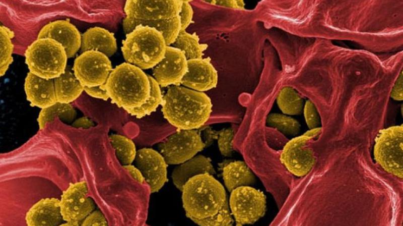Telangana: Influenza A Cases Rise, Elderly Hit Hardest