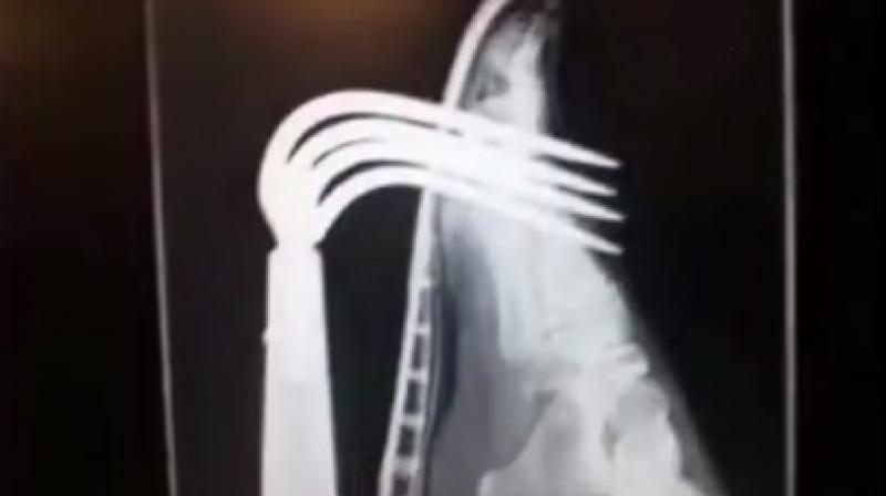 Rakes are the eighth most common cause for garden injuries (Photo: YouTube)