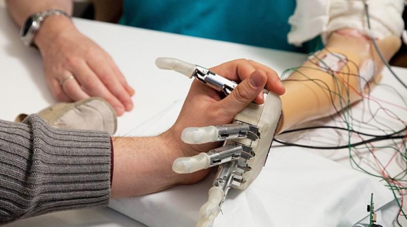 The device is inspired by the bionic hand given to Luke Skywalker in Star Wars series (Photo: AFP)