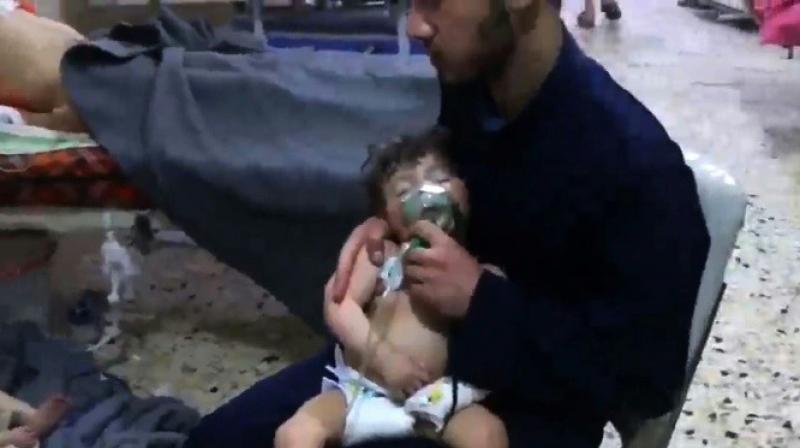 A volunteer holds an oxygen mask over a childs face at a hospital following an alleged chemical attack on the rebel-held town of Douma. (Photo: AFP)