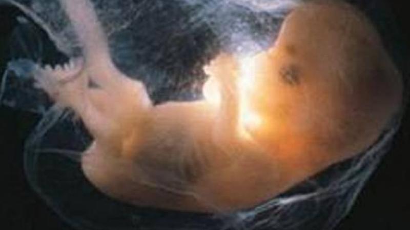 Three foetuses were seen floating on Monday in a drainage channel in Tiruchirappalli, Tamil Nadu. (Photo: PTI/Representational)