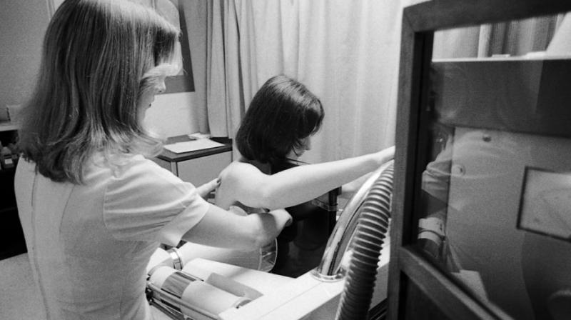 Current screening methods such as mammography are not well-suited for young women. (Photo: AP)