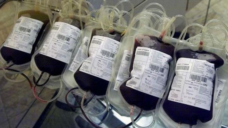 Despite its high AIDS rate, South Africa is able to provide safe blood to patients. (Representational image)