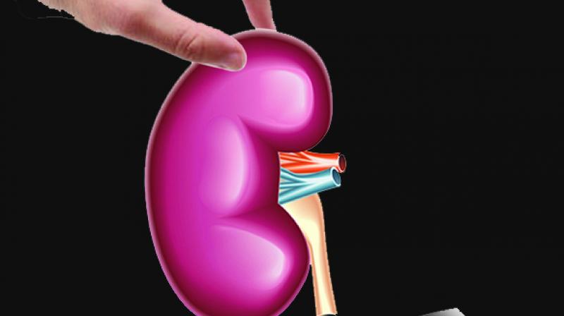 The Gachibowli police booked a case of illegal kidney transplant against the staff of Continental Hospital at Nanakramguda on a complaint by a private doctor who had worked as a medical director in the hospital. (Representational image)