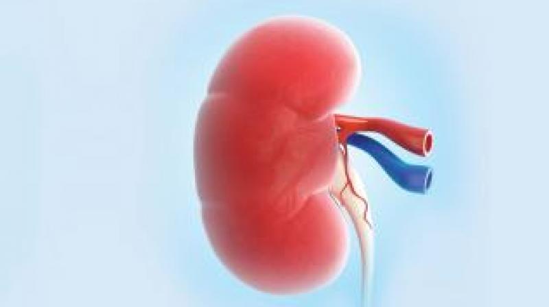 In India, donors have to be related to the patient they are donating the kidney to in order to stop poor people from selling their kidneys for money and endangering their own health. (Representational image)
