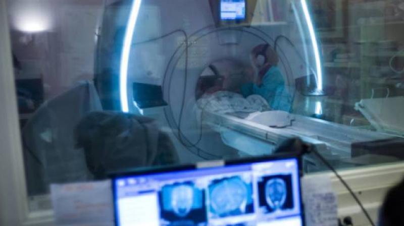 Having MRI findings of MS without any symptoms of the disease has been termed radiologically isolated syndrome (RIS) (Photo: AFP)
